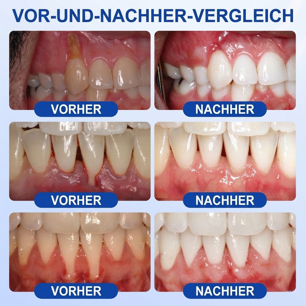 🌿Solaroza® Zahnfleisch-Regeneration Parodontales Reparaturgel