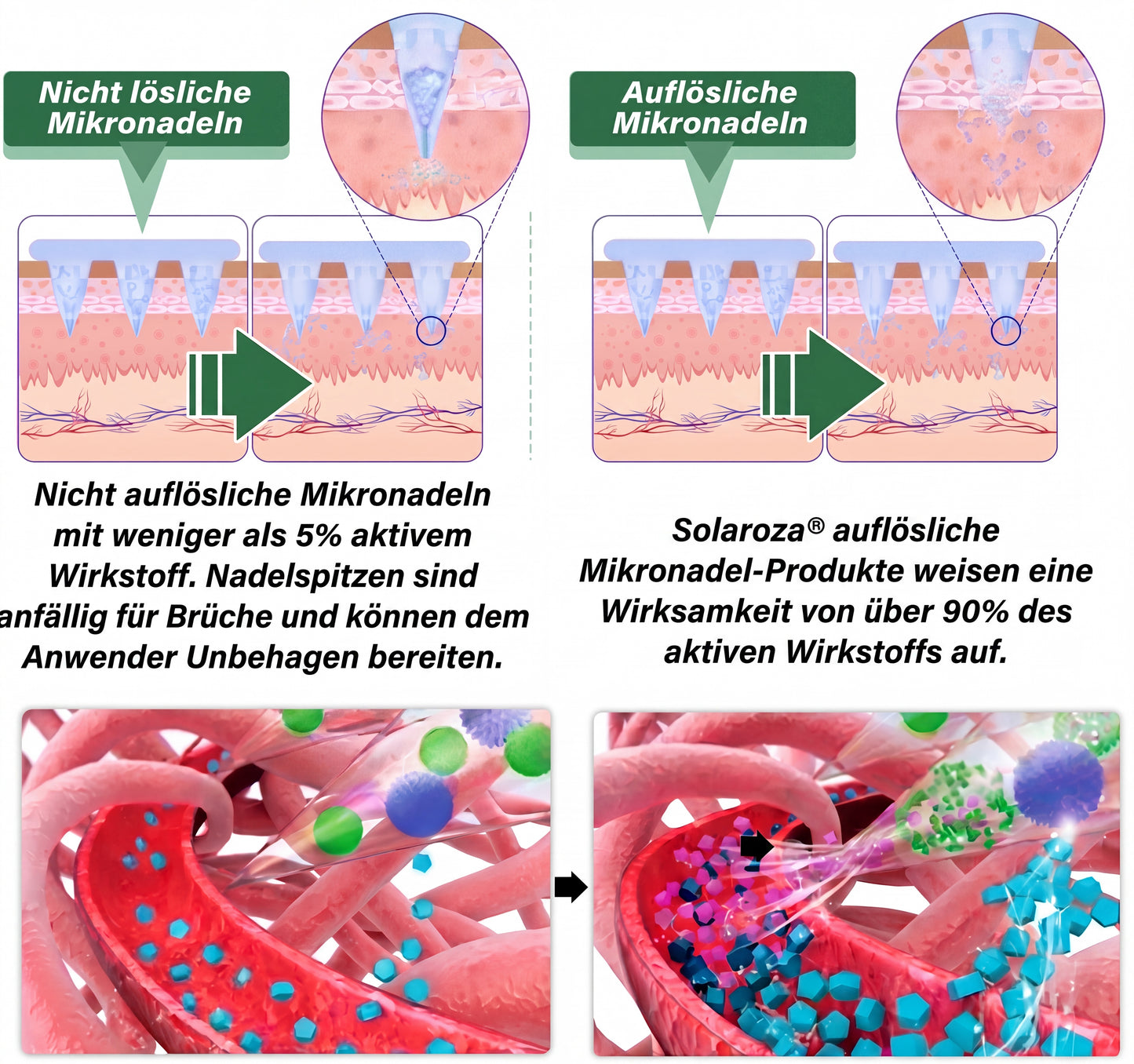 🌿CE-zertifiziert & GMP-zertifiziert | 🧑‍⚕️🩺 Solaroza® Moringa & Berberin 10-IN-1 Fortschrittliches Nano-Mikronadelpflaster | Wissenschaftlich belegt | 10-in-1 Formel | Ergebnisse in 5 Tagen🌿
