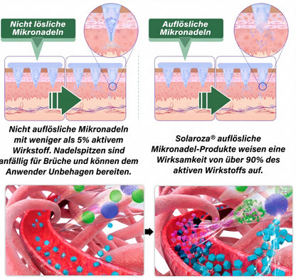 🌿CE-zertifiziert & GMP-zertifiziert | 🧑‍⚕️🩺 Solaroza® Moringa & Berberin 10-IN-1 Fortschrittliches Nano-Mikronadelpflaster | Wissenschaftlich belegt | 10-in-1 Formel | Ergebnisse in 5 Tagen🌿