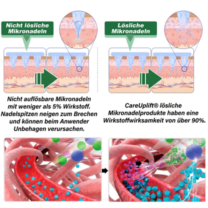 CE-zertifiziert & GMP-zertifiziert | 🧑‍⚕️🩺 Solaroza® Moringa & Berberin 10-IN-1 Fortschrittliches Nano-Mikronadelpflaster | Wissenschaftlich belegt | 10-in-1 Formel | Ergebnisse in 5 Tagen🚀